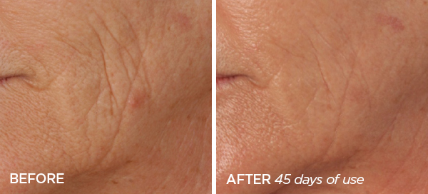 R45 Anti-Aging Retinol Cream | Anti-Aging Retinol System – BeautyBio